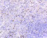 TIA-1 Antibody in Immunohistochemistry (Paraffin) (IHC (P))