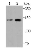 FGFR2 Antibody in Western Blot (WB)