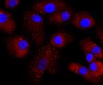 Transthyretin Antibody in Immunocytochemistry (ICC/IF)