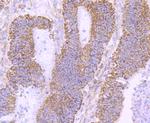 NUR77 Antibody in Immunohistochemistry (Paraffin) (IHC (P))