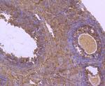 NUR77 Antibody in Immunohistochemistry (Paraffin) (IHC (P))