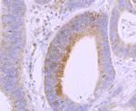 VDR Antibody in Immunohistochemistry (Paraffin) (IHC (P))