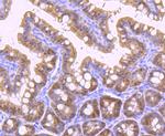 VDR Antibody in Immunohistochemistry (Paraffin) (IHC (P))