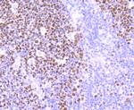 MSH6 Antibody in Immunohistochemistry (Paraffin) (IHC (P))