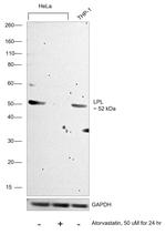 LPL Antibody in Western Blot (WB)