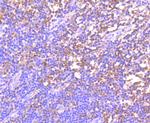 GCN2 Antibody in Immunohistochemistry (Paraffin) (IHC (P))