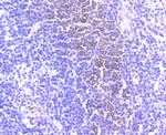 CD39 Antibody in Immunohistochemistry (Paraffin) (IHC (P))