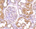 TrxR1 Antibody in Immunohistochemistry (Paraffin) (IHC (P))