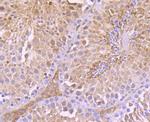 TrxR1 Antibody in Immunohistochemistry (Paraffin) (IHC (P))