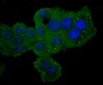 PKC epsilon Antibody in Immunocytochemistry (ICC/IF)