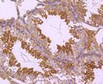 PKC epsilon Antibody in Immunohistochemistry (Paraffin) (IHC (P))