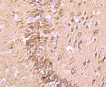 Fascin Antibody in Immunohistochemistry (Paraffin) (IHC (P))