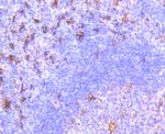 Fascin Antibody in Immunohistochemistry (Paraffin) (IHC (P))