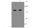 ACE Antibody in Western Blot (WB)