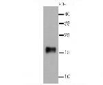gamma Synuclein Antibody in Western Blot (WB)