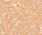 Ferritin Light Chain Antibody in Immunohistochemistry (Paraffin) (IHC (P))