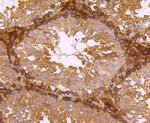 Ferritin Light Chain Antibody in Immunohistochemistry (Paraffin) (IHC (P))