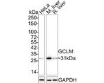 GCLM Antibody in Immunocytochemistry (ICC/IF)