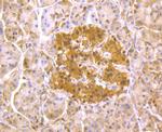 PSMA1 Antibody in Immunohistochemistry (Paraffin) (IHC (P))