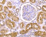 IKK epsilon Antibody in Immunohistochemistry (Paraffin) (IHC (P))