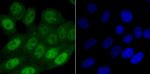 SAMHD1 Antibody in Immunocytochemistry (ICC/IF)