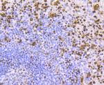 SAMHD1 Antibody in Immunohistochemistry (Paraffin) (IHC (P))