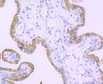 TGM2 Antibody in Immunohistochemistry (Paraffin) (IHC (P))