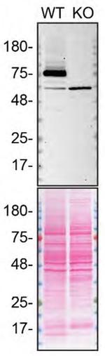 TGM2 Antibody in Western Blot (WB)