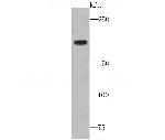 Complement C4 Antibody in Western Blot (WB)