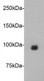 JPH2 Antibody in Western Blot (WB)