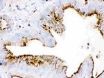 Cathepsin D Antibody in Immunohistochemistry (Paraffin) (IHC (P))