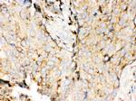 Cathepsin D Antibody in Immunohistochemistry (Paraffin) (IHC (P))