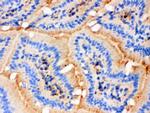 Actin Antibody in Immunohistochemistry (Frozen) (IHC (F))