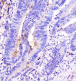 Adenosine Deaminase Antibody in Immunohistochemistry (Paraffin) (IHC (P))