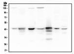 Adenosine Deaminase Antibody in Western Blot (WB)