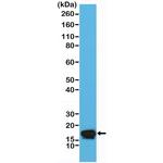 Stathmin 1 Antibody in Western Blot (WB)