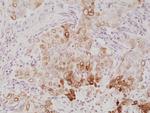 COX2 Antibody in Immunohistochemistry (Paraffin) (IHC (P))