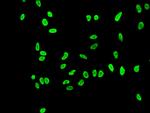 H3K56ac Antibody in Immunocytochemistry (ICC/IF)