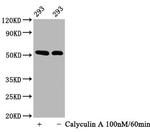 Phospho-p53 (Ser392) Antibody in Western Blot (WB)