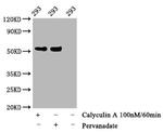 Phospho-p53 (Thr55) Antibody in Western Blot (WB)