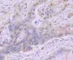 CK2 beta Antibody in Immunohistochemistry (Paraffin) (IHC (P))