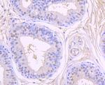 CK2 beta Antibody in Immunohistochemistry (Paraffin) (IHC (P))