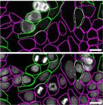 MATR3 Antibody in Immunocytochemistry (ICC/IF)