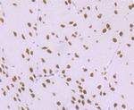 MATR3 Antibody in Immunohistochemistry (Paraffin) (IHC (P))