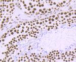 MATR3 Antibody in Immunohistochemistry (Paraffin) (IHC (P))