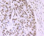 MATR3 Antibody in Immunohistochemistry (Paraffin) (IHC (P))