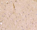 PFKM Antibody in Immunohistochemistry (Paraffin) (IHC (P))