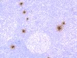 Mast Cell Chymase Antibody in Immunohistochemistry (Paraffin) (IHC (P))