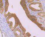 GSTP1 Antibody in Immunohistochemistry (Paraffin) (IHC (P))