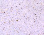 GSTP1 Antibody in Immunohistochemistry (Paraffin) (IHC (P))